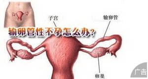 女性输卵管不孕检查项目有哪些