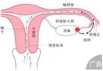 输卵管性不孕症