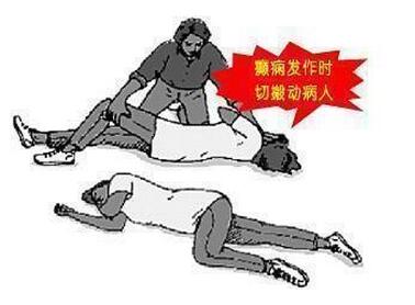 癫痫发病前有哪些征兆